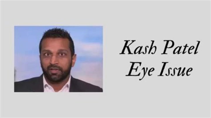 Does Kash Patel Have a Glass Eye? Exploring the Truth Behind the Rumors